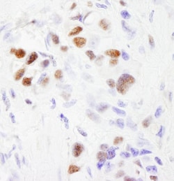 SF3B2 Antibody, Novus Biologicals 0.1mL | Buy Online | Novus Biologicals | Fisher Scientific